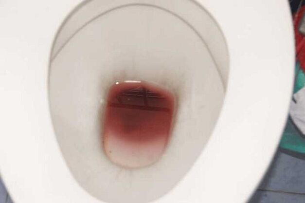 uočavanje kod muškaraca kada su uzbuđeni